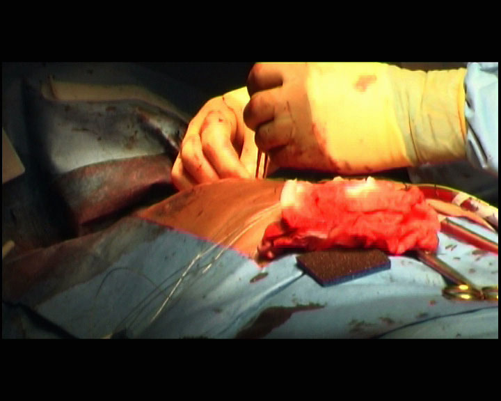 Jordan Baseman. Still from Under the Blood. Commissioned by Arts Council England’s Collaborative Arts Unit with Papworth Hospital’s Heart and Lung Transplant Unit. The films were shown in a solo exhibition at Wysing Arts and the Royal Pump Rooms at Leamington Spa. Under the Blood was also screened in the group exhibition Wonderful: Visions of the Near Future at the Arnolfini, Bristol and Cornerhouse, Manchester (2004). 1 + 1 = 1 and Under the Blood were exhibited at the inaugural exhibition Heart, Wellcome Trust Galleries, London (2007). Courtesy of the artist and Matt's Gallery, London.