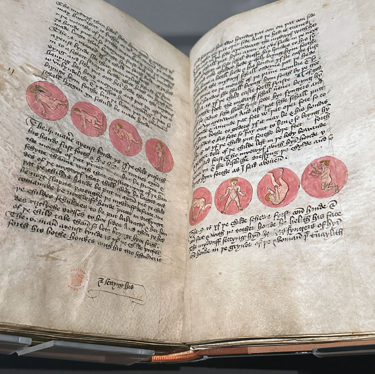The Sekenesse of Wymmen, England, 15th Century. © British Library Board.