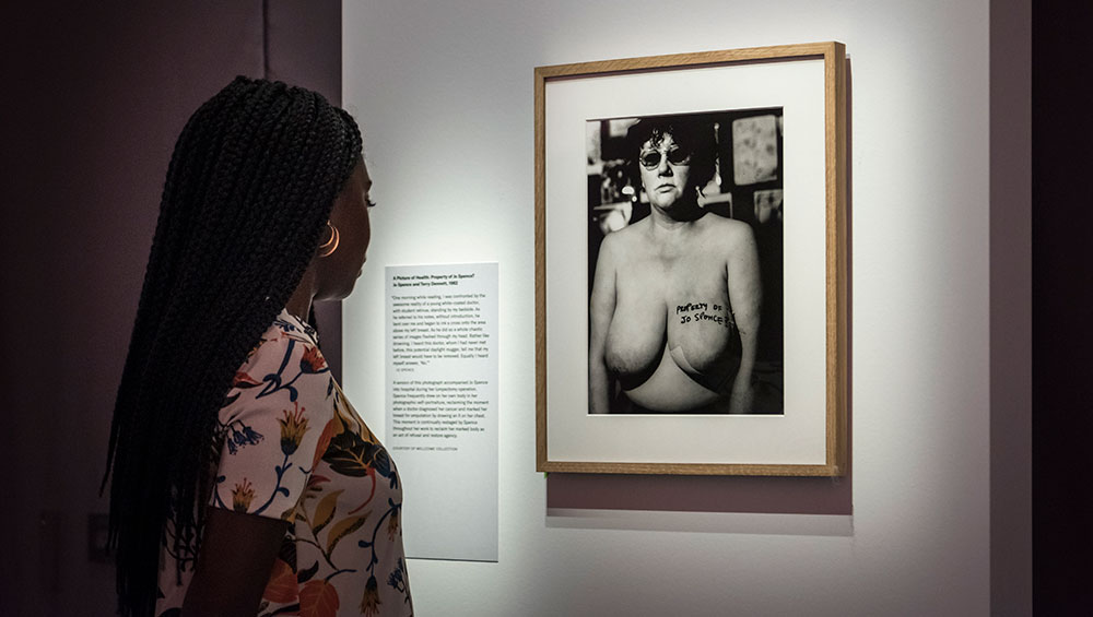 The Picture of Health, Jo Spence in collaboration with Rosy Martin, Maggie Murray and Terry Dennet, 1982. Copyright The Jo Spence Memorial Archive, Ryerson University, Courtesy MACBA Collection.