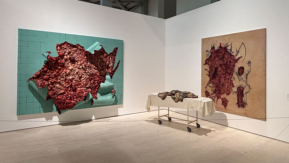 Works by Adriana Varejão in Extirpations room. Installation view, Paula Rego and Adriana Varejão: Between Your Teeth, Centro de Arte Moderna Gulbenkian, Lisbon, 2025. Photo: Caroline Menezes.