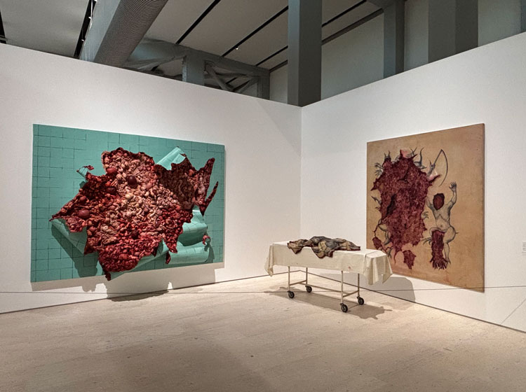 Works by Adriana Varejão in Extirpations room. Installation view, Paula Rego and Adriana Varejão: Between Your Teeth, Centro de Arte Moderna Gulbenkian, Lisbon, 2025. Photo: Caroline Menezes.