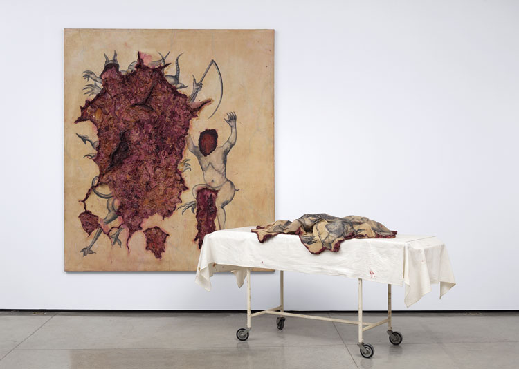 Adriana Varejão. Extirpation of Evil by Incision, 1994. Susana and Ricardo Steinbruch Collection. Photo: Sergio Guerini. © Adriana Varejão.